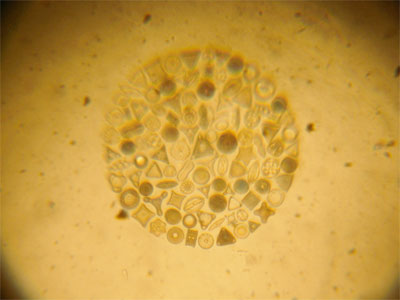 Diatoms in transmitted light