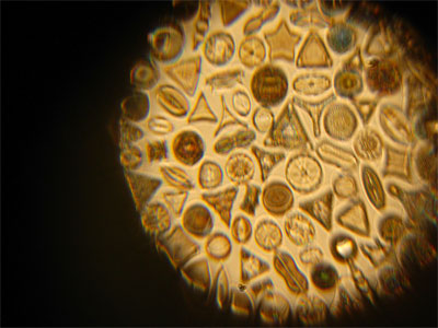 Diatom Imaging