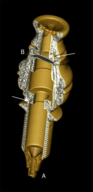 CT Scan of ivory scope