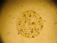 Circle of 100 diatoms